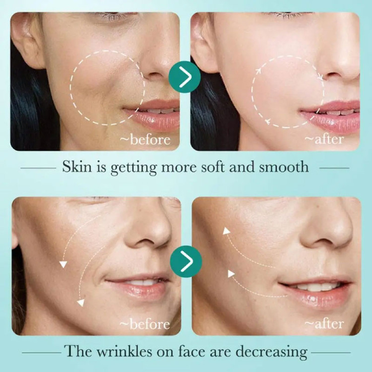 سرم آبرسان صورت بیواکوا (بایوآکوا) مدل هیالورونیک اسید حجم 30 میلی لیتر Bioaqua Hyaluronic Acid Serum