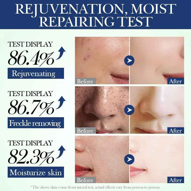 ماسک صورت ورقه ای ضد لک و جوان کننده بلوبری و چای سبز وزن 25 گرم