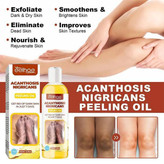 روغن لایهبردار از بین برنده تیرگی پوست آکانتوز نیگریکانس Acanthosis Nigricans