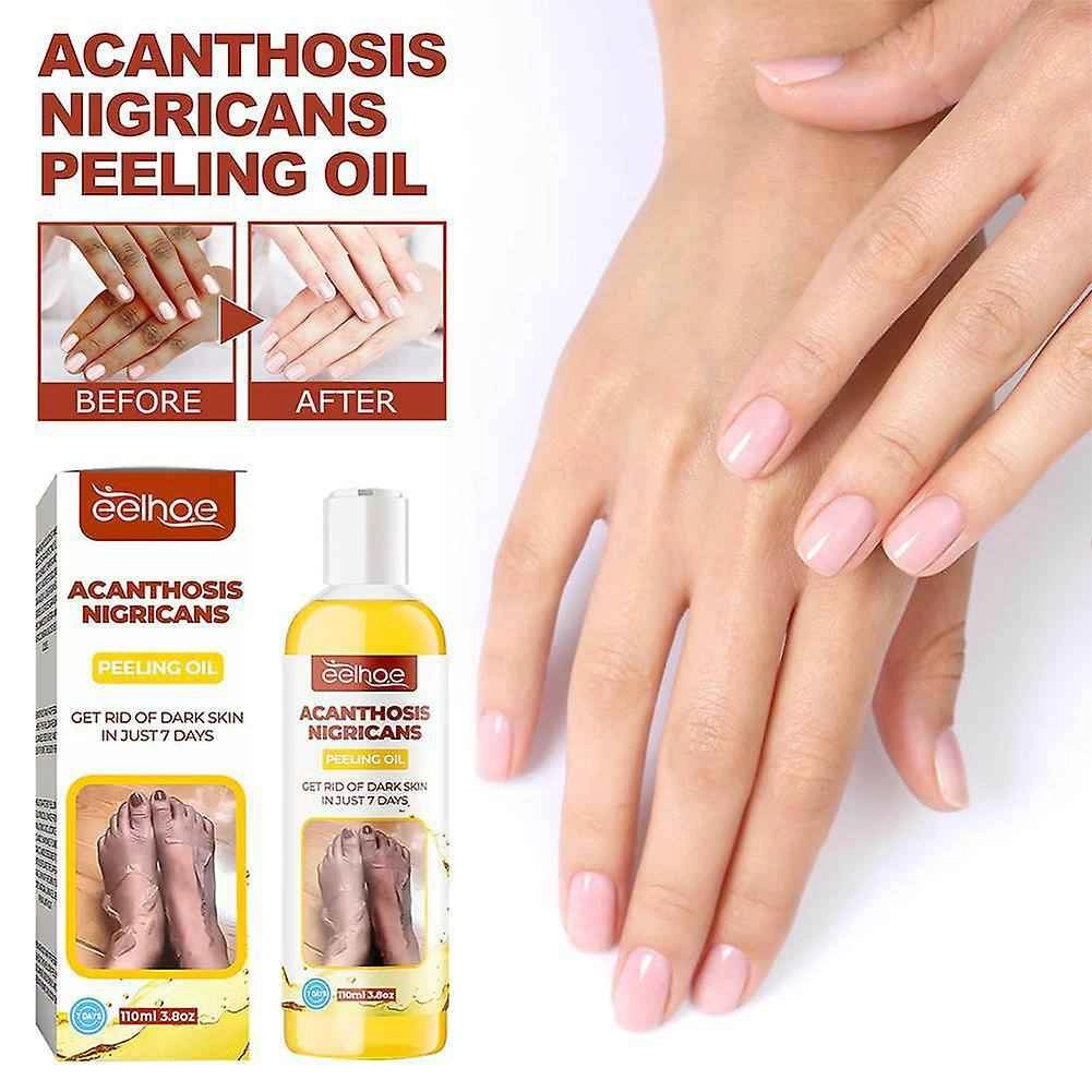 روغن لایه‌بردار از بین برنده تیرگی پوست  آکانتوز نیگریکانس Acanthosis Nigricans