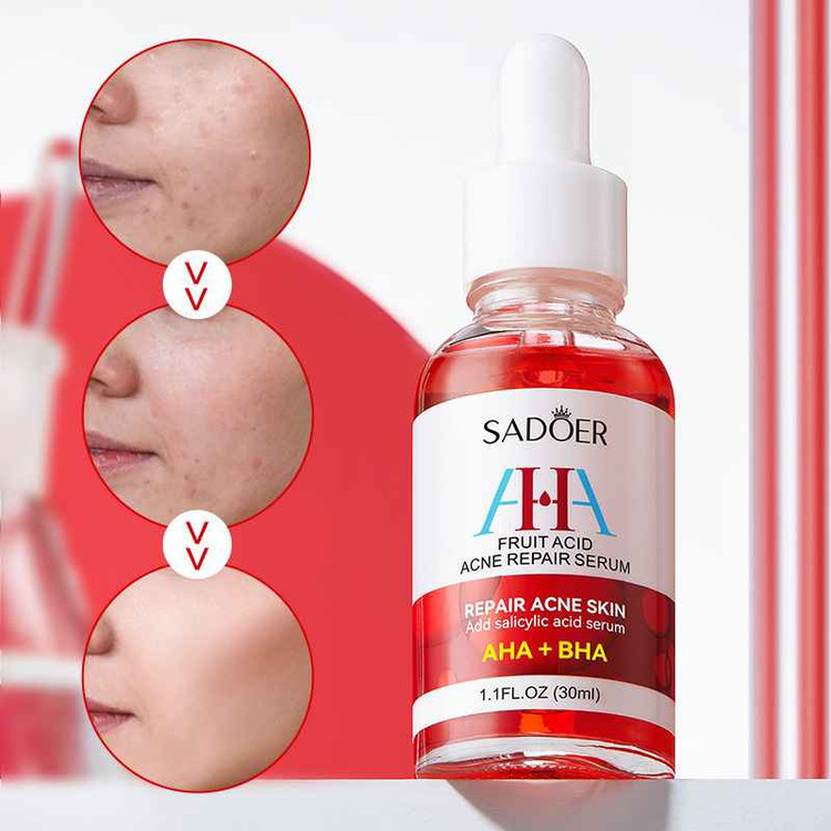 سرم صورت ترمیمکننده پوست و کوچککننده منافذ سادور مدل AHA + BHA حجم 30 میل SADOER