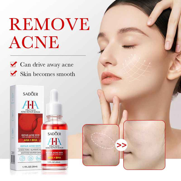 سرم صورت ترمیمکننده پوست و کوچککننده منافذ سادور مدل AHA + BHA حجم 30 میل SADOER