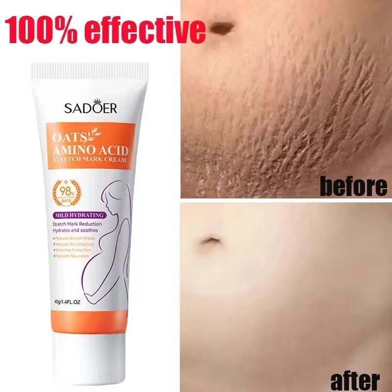 کرم ترمیم کننده استرچ مارک سادور حاوی جو دوسر و آمینو اسید وزن 40 گرم SADOER