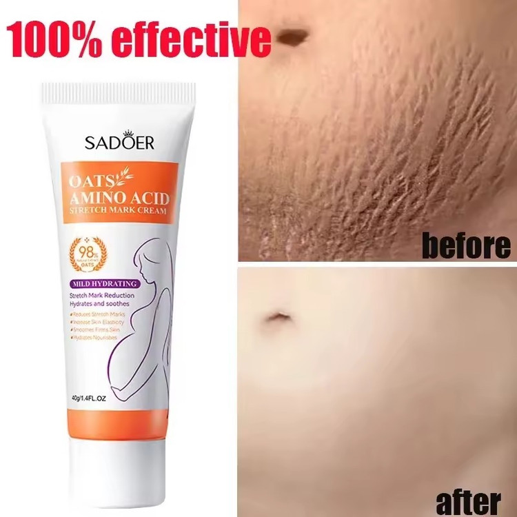 کرم ترمیم کننده استرچ مارک سادور حاوی جو دوسر و آمینو اسید وزن 40 گرم SADOER