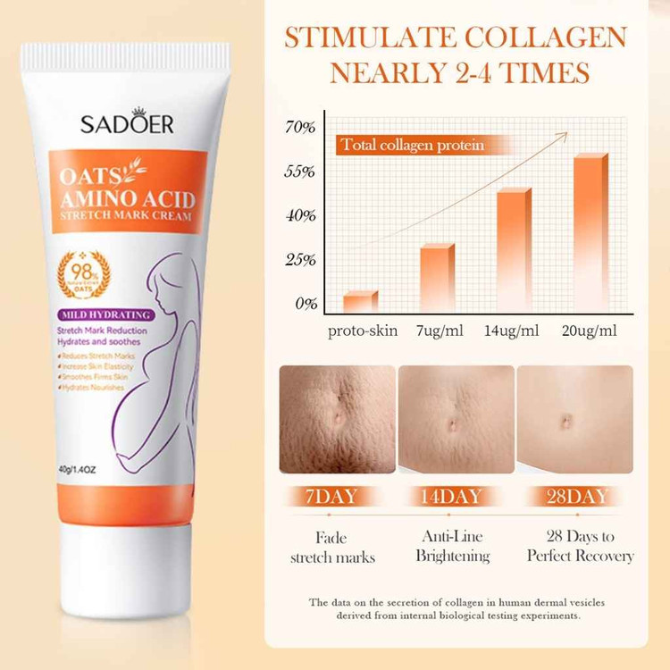 کرم ترمیم کننده استرچ مارک سادور حاوی جو دوسر و آمینو اسید وزن 40 گرم SADOER