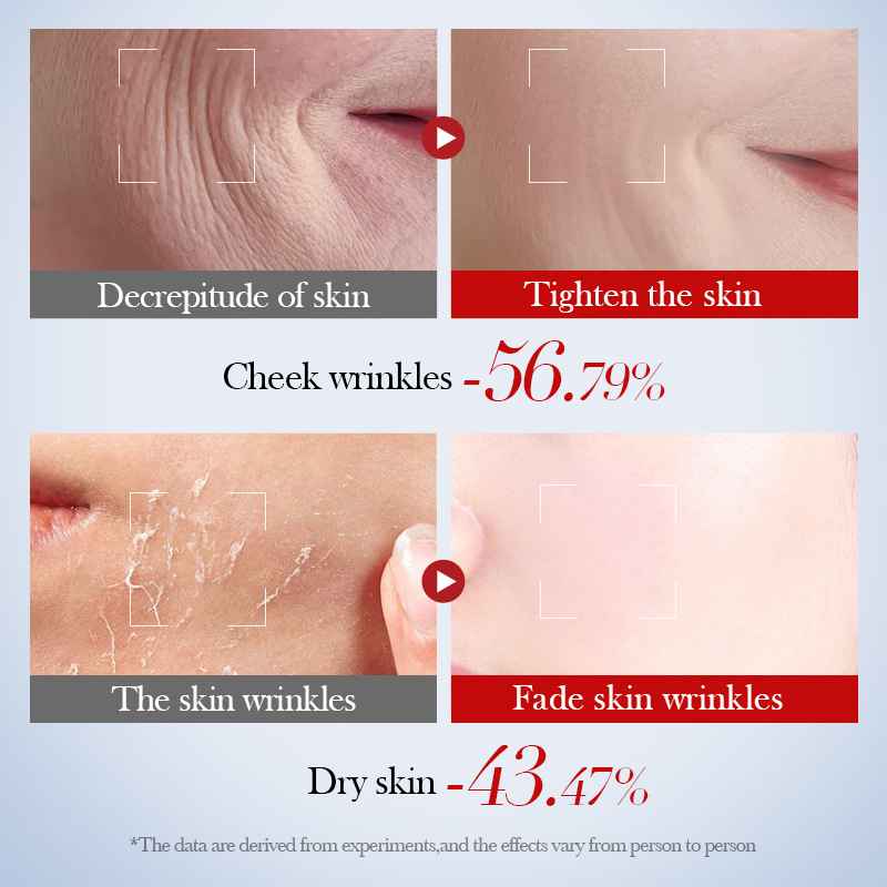 SADOER ANTI-WRINKLE SNAIL COLLAGEN TONER