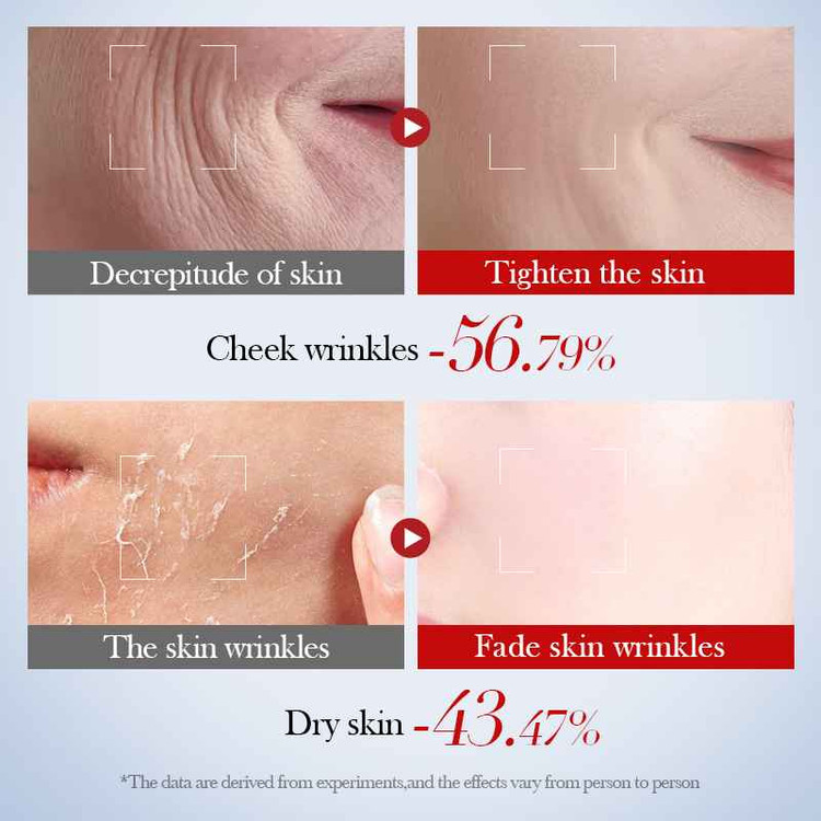 SADOER ANTI-WRINKLE SNAIL COLLAGEN TONER