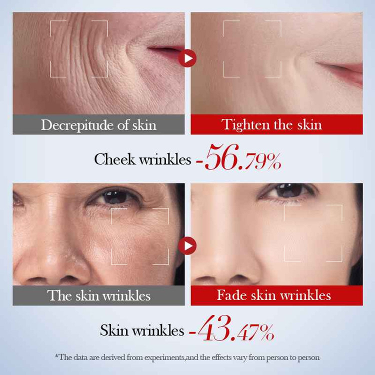 لوسیون صورت ضد چروک و سفید کننده کلاژن و حلزون سادور SADOER وزن 115 میل