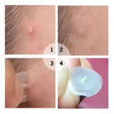 پک پچ ضد جوش و آکنه سادور مدل کاور کننده و ترمیم کننده 36 عددی