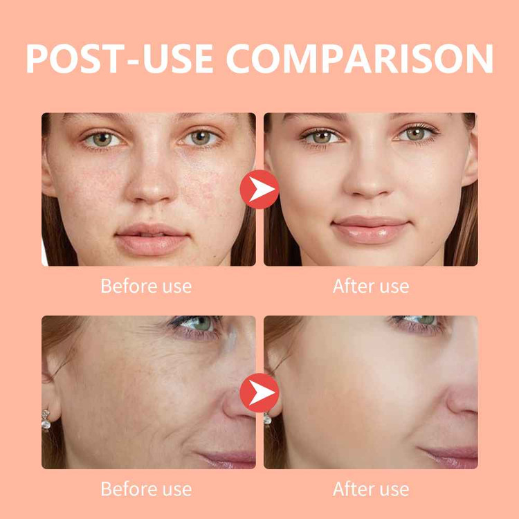 ماسک ورقه ای صورت سفید و مرطوب کننده توت فرنگی مویام وزن 25 گرم MOOYAM