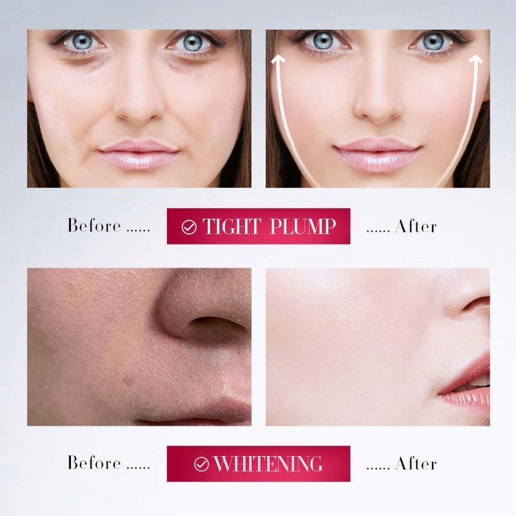 کرم لیفت و سفتکننده صورت سادور مدل V-FACE وزن 30 گرم