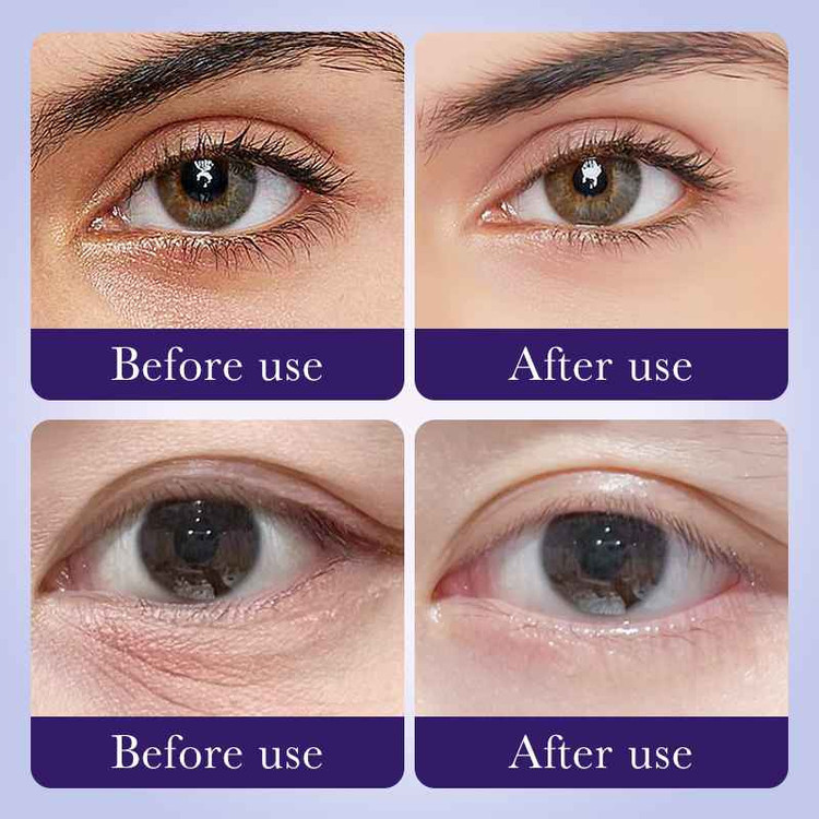 کرم دور چشم هسته انگور سادور وزن 20 گرم SADOER