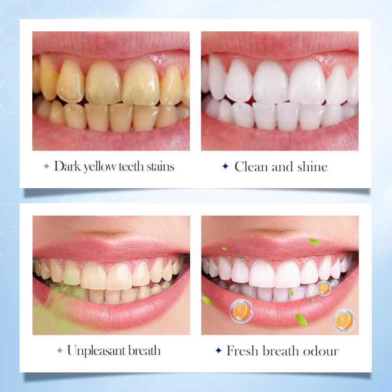 قرص خمیر دندان سفید کننده و آنتی پلاک سادور طعم هلو بسته 30 عددی