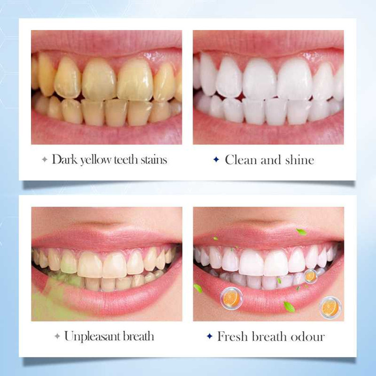 قرص خمیر دندان سفید کننده و آنتی پلاک سادور طعم هلو بسته 30 عددی