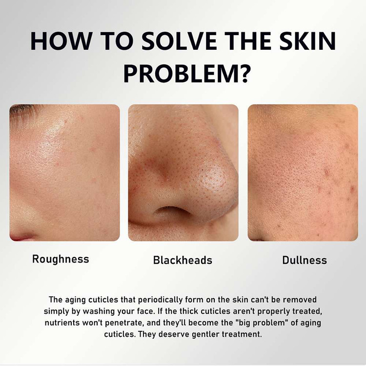سرم صورت لایهبردار برنج سیاه و نیاسینامید مویام حجم 60 میل