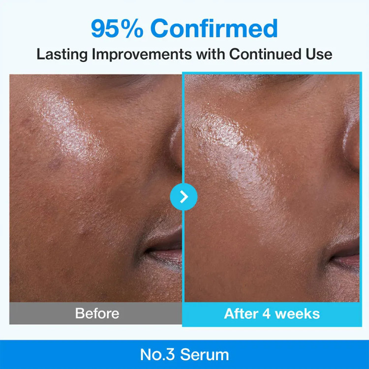 سرم صورت کنترل منافد نامبوزین شماره 3 مدل Blue Bio-Retinol حجم 30 میل